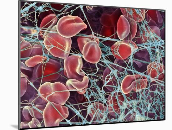 Blood Clot, SEM-Steve Gschmeissner-Mounted Photographic Print