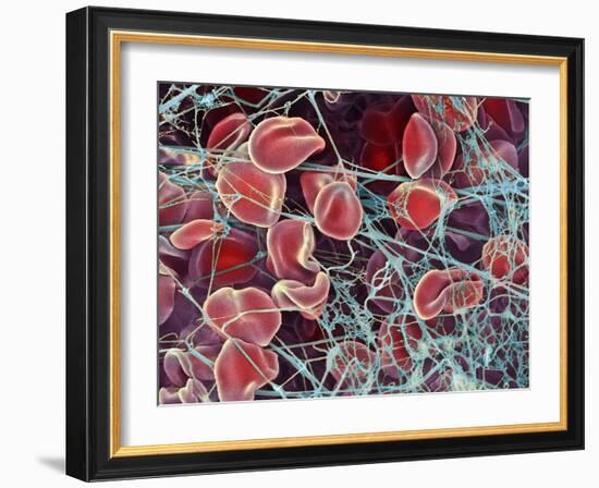 Blood Clot, SEM-Steve Gschmeissner-Framed Photographic Print