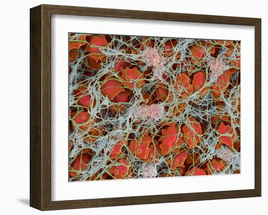 Blood Clot, SEM-Steve Gschmeissner-Framed Photographic Print