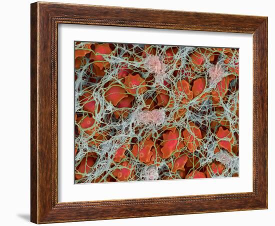 Blood Clot, SEM-Steve Gschmeissner-Framed Photographic Print