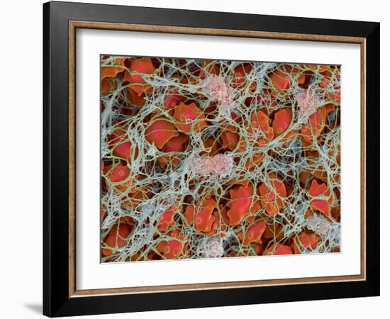 Blood Clot, SEM-Steve Gschmeissner-Framed Photographic Print