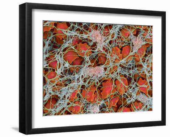 Blood Clot, SEM-Steve Gschmeissner-Framed Photographic Print