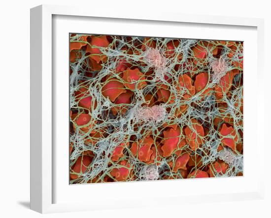 Blood Clot, SEM-Steve Gschmeissner-Framed Photographic Print