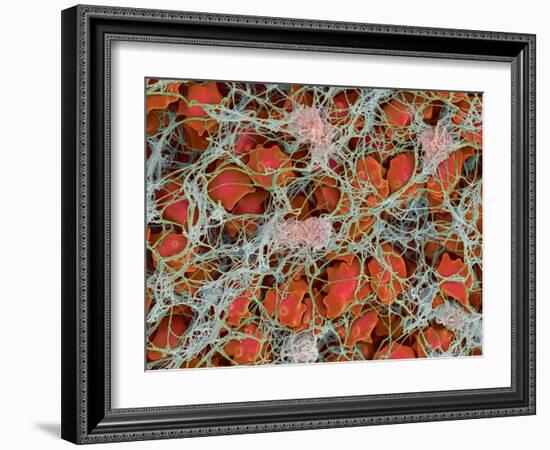 Blood Clot, SEM-Steve Gschmeissner-Framed Photographic Print