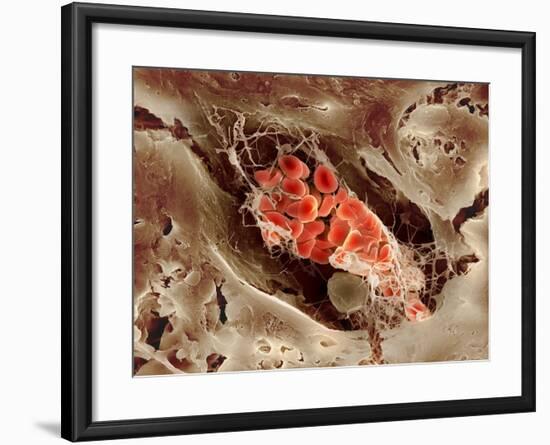 Blood Clot, SEM-Science Photo Library-Framed Photographic Print