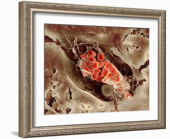 Blood Clot, SEM-Science Photo Library-Framed Photographic Print