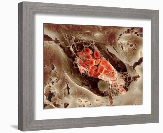 Blood Clot, SEM-Science Photo Library-Framed Photographic Print