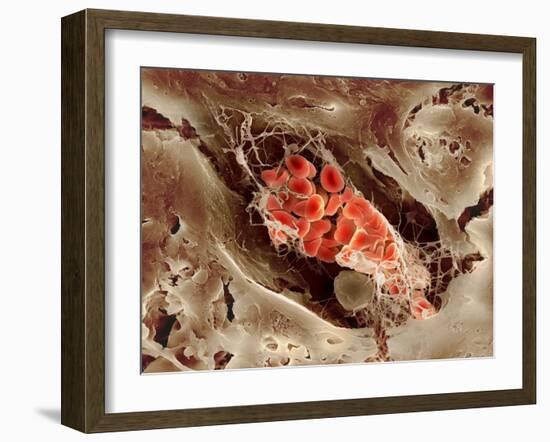Blood Clot, SEM-Science Photo Library-Framed Photographic Print