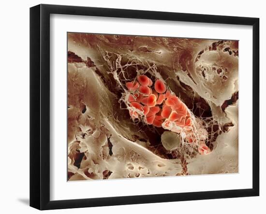 Blood Clot, SEM-Science Photo Library-Framed Photographic Print