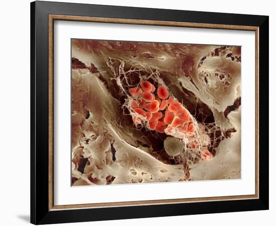 Blood Clot, SEM-Science Photo Library-Framed Photographic Print