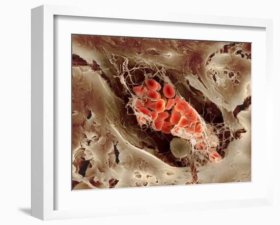 Blood Clot, SEM-Science Photo Library-Framed Photographic Print