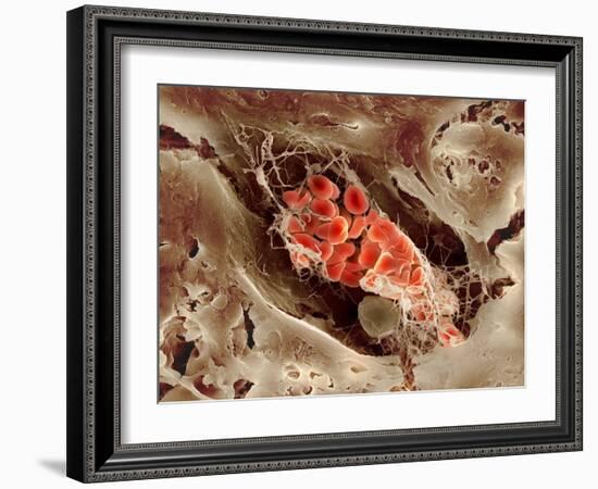 Blood Clot, SEM-Science Photo Library-Framed Photographic Print