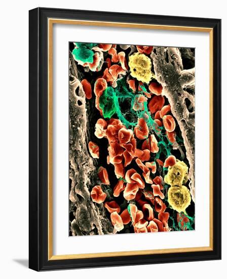 Blood Clot, SEM-Science Photo Library-Framed Photographic Print