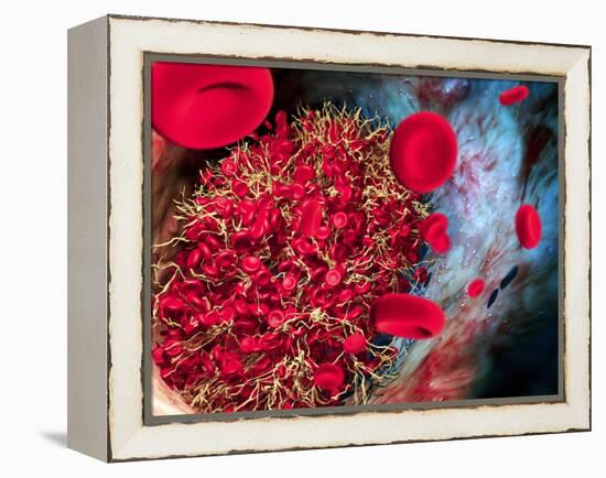 Blood Clot-Roger Harris-Framed Premier Image Canvas