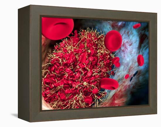 Blood Clot-Roger Harris-Framed Premier Image Canvas