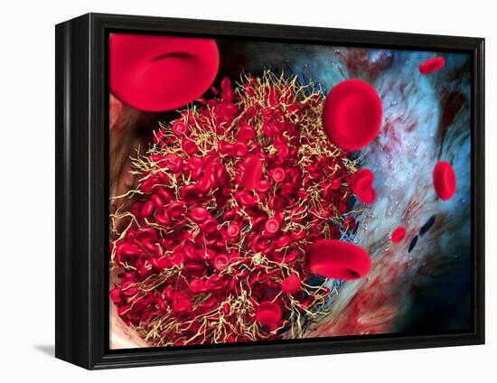 Blood Clot-Roger Harris-Framed Premier Image Canvas