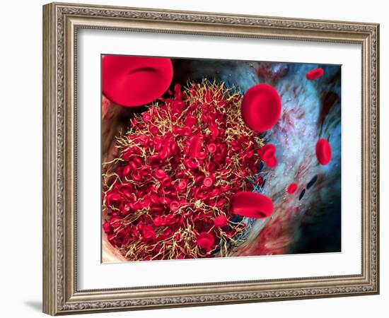 Blood Clot-Roger Harris-Framed Photographic Print