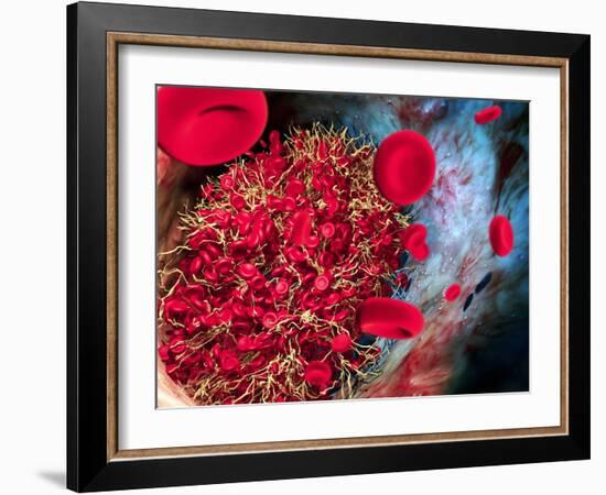 Blood Clot-Roger Harris-Framed Photographic Print