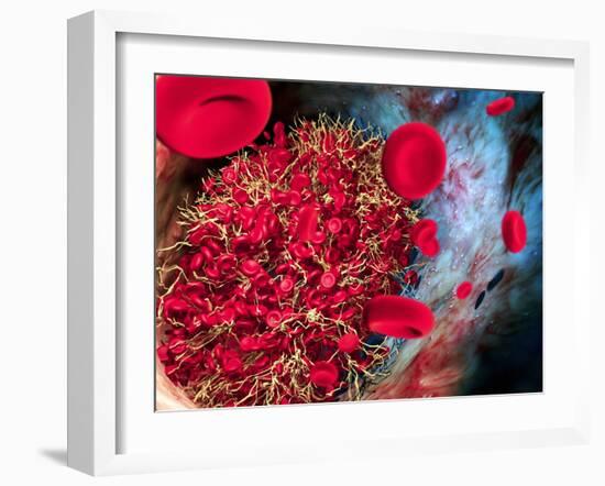 Blood Clot-Roger Harris-Framed Photographic Print