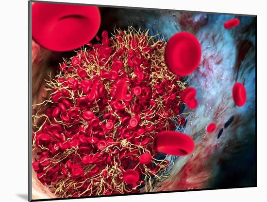 Blood Clot-Roger Harris-Mounted Photographic Print