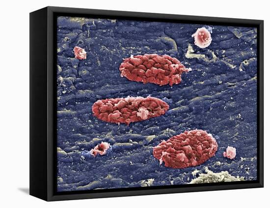 Blood Clots, SEM-Science Photo Library-Framed Premier Image Canvas