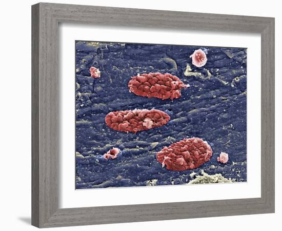 Blood Clots, SEM-Science Photo Library-Framed Photographic Print