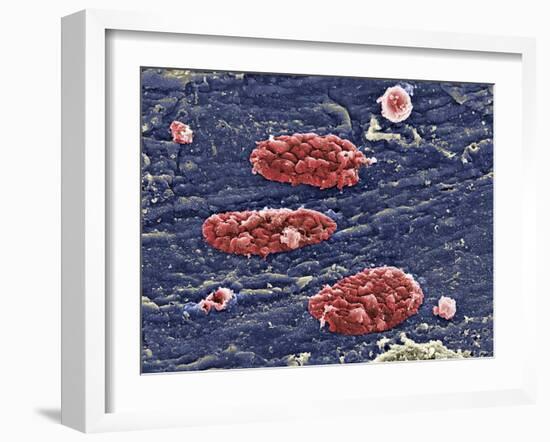 Blood Clots, SEM-Science Photo Library-Framed Photographic Print