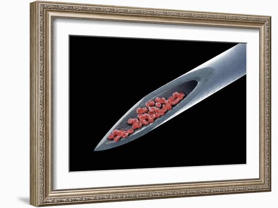 Blood on a Needle, SEM-Steve Gschmeissner-Framed Photographic Print