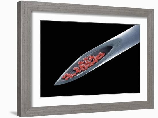 Blood on a Needle, SEM-Steve Gschmeissner-Framed Photographic Print