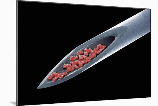 Blood on a Needle, SEM-Steve Gschmeissner-Mounted Photographic Print