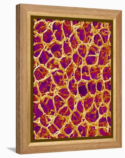 Blood Vessel Cast from Colon of a Rat-Micro Discovery-Framed Premier Image Canvas