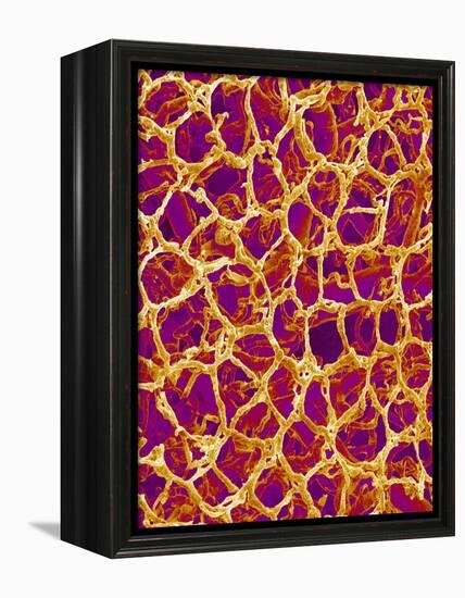 Blood Vessel Cast from Colon of a Rat-Micro Discovery-Framed Premier Image Canvas