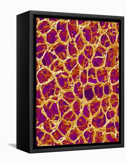 Blood Vessel Cast from Colon of a Rat-Micro Discovery-Framed Premier Image Canvas