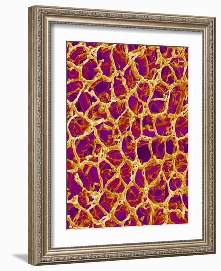 Blood Vessel Cast from Colon of a Rat-Micro Discovery-Framed Photographic Print