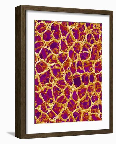 Blood Vessel Cast from Colon of a Rat-Micro Discovery-Framed Photographic Print