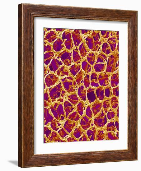 Blood Vessel Cast from Colon of a Rat-Micro Discovery-Framed Photographic Print