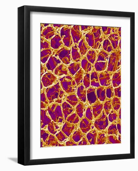 Blood Vessel Cast from Colon of a Rat-Micro Discovery-Framed Photographic Print