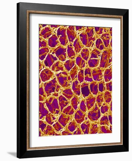 Blood Vessel Cast from Colon of a Rat-Micro Discovery-Framed Photographic Print