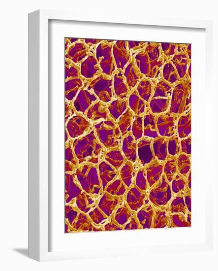 Blood Vessel Cast from Colon of a Rat-Micro Discovery-Framed Photographic Print