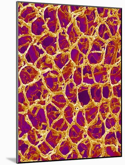 Blood Vessel Cast from Colon of a Rat-Micro Discovery-Mounted Photographic Print