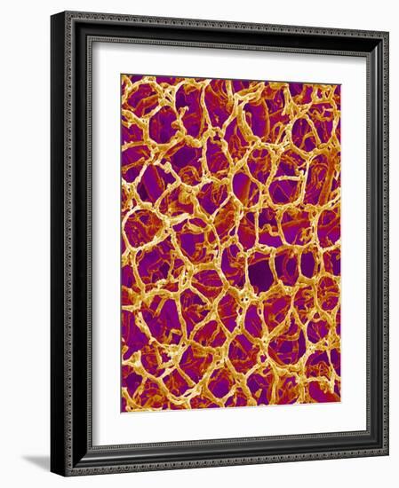 Blood Vessel Cast from Colon of a Rat-Micro Discovery-Framed Photographic Print