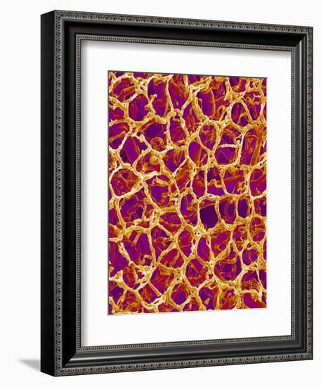 Blood Vessel Cast from Colon of a Rat-Micro Discovery-Framed Photographic Print