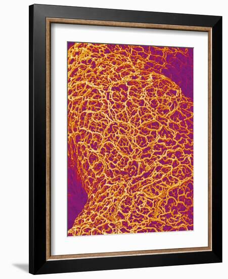 Blood Vessel Cast from Rat Colon-Micro Discovery-Framed Photographic Print