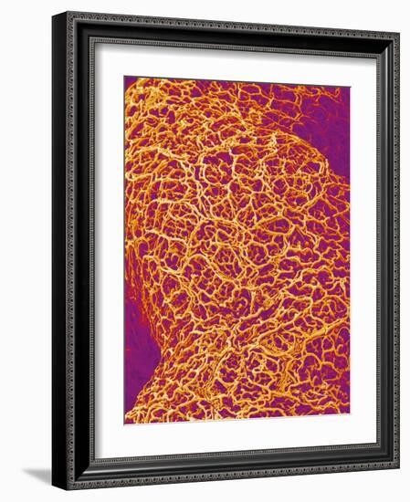 Blood Vessel Cast from Rat Colon-Micro Discovery-Framed Photographic Print