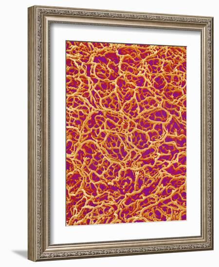 Blood Vessel Cast from Rat Colon-Micro Discovery-Framed Photographic Print