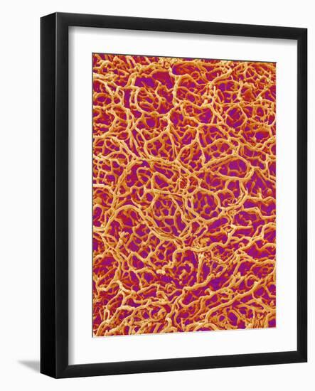 Blood Vessel Cast from Rat Colon-Micro Discovery-Framed Photographic Print