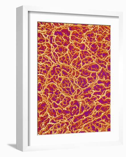 Blood Vessel Cast from Rat Colon-Micro Discovery-Framed Photographic Print