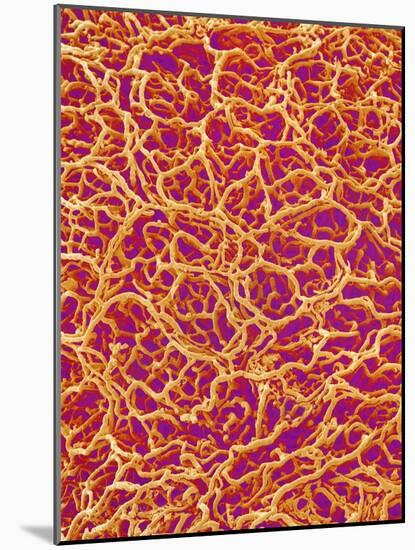 Blood Vessel Cast from Rat Colon-Micro Discovery-Mounted Photographic Print