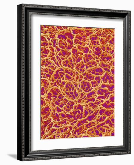 Blood Vessel Cast from Rat Colon-Micro Discovery-Framed Photographic Print