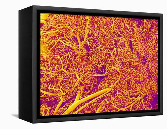 Blood Vessel Cast from Rat Pancreas-Micro Discovery-Framed Premier Image Canvas